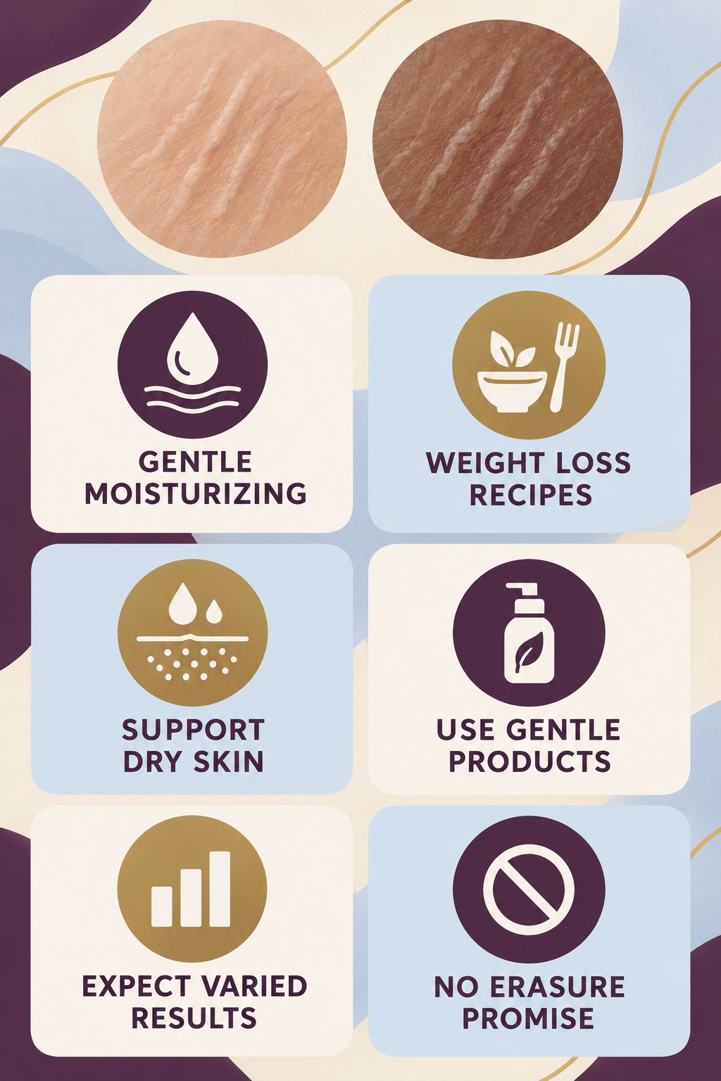 Gentle Moisturizing Without Miracle Claims infographic for Weight Loss Recipes with four concise, body-neutral stretch-mark skincare points.